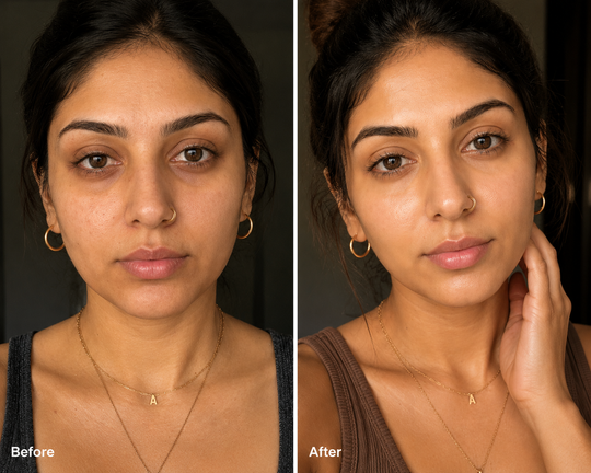 Under-Eye Brightening